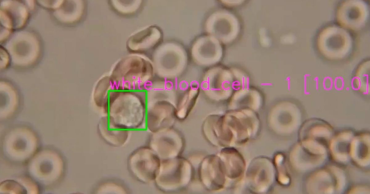 Detecting White Blood Cell Under Microscope using Computer Vision